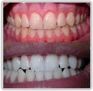 "Me sinto muito mais bonito e atraente" João F Vasconcelos (Capital-SP)